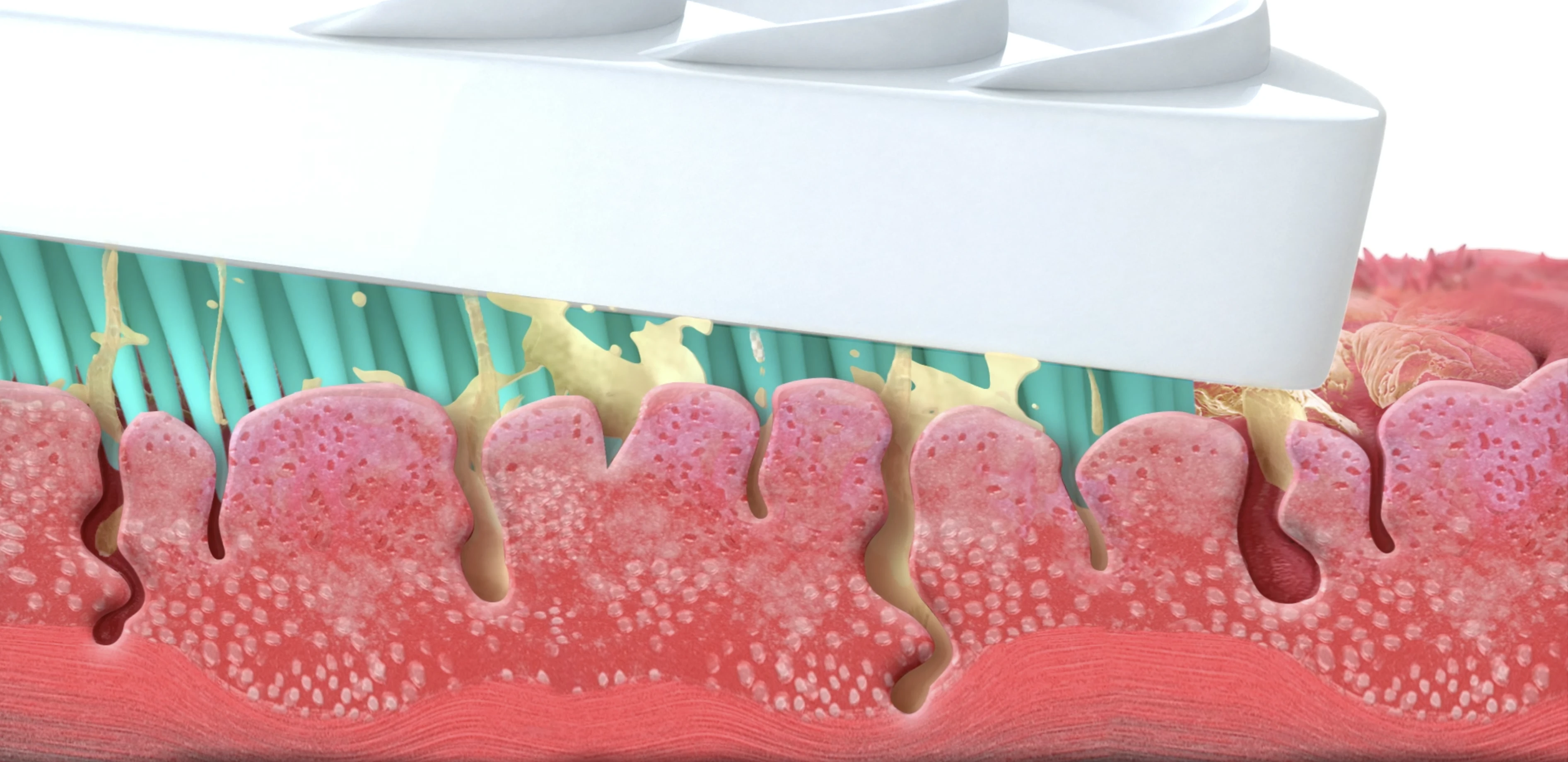  Bester zungenreiniger zungenschaber