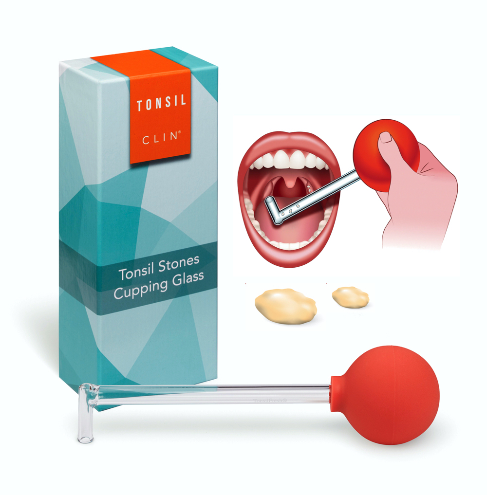 Tonsilclin mandelsteine entfernen